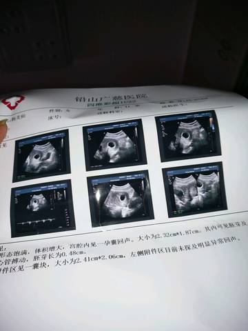journal_insert_pic_693276507