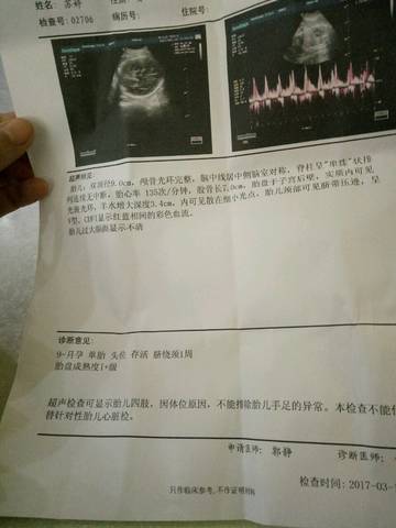 journal_insert_pic_694925601