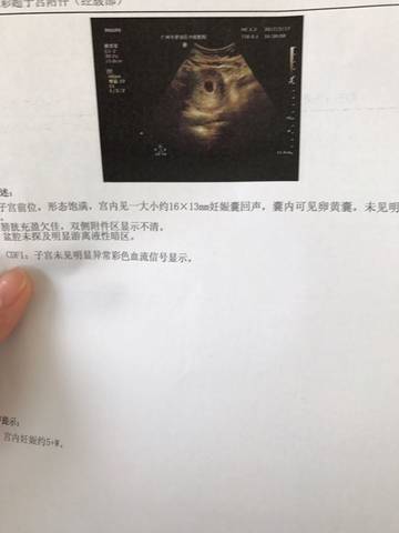 journal_insert_pic_695818588