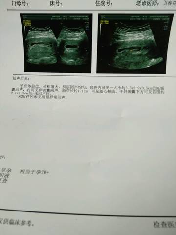 journal_insert_pic_695654244