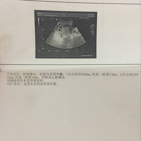 journal_insert_pic_698083728