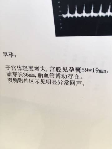 journal_insert_pic_698418423