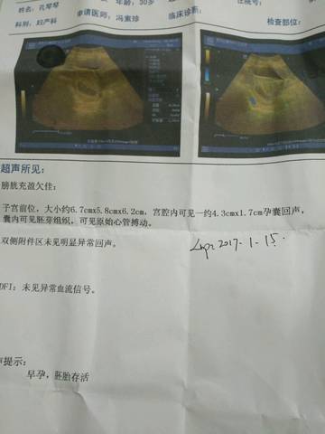 journal_insert_pic_700054737
