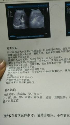 journal_insert_pic_701132123