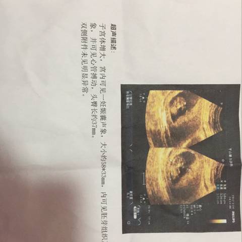 journal_insert_pic_700967685