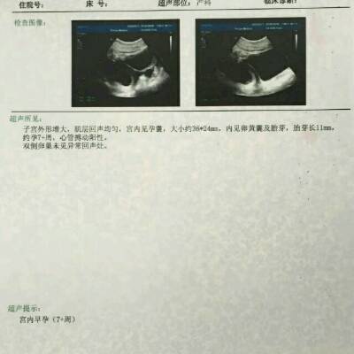 journal_insert_pic_701290486