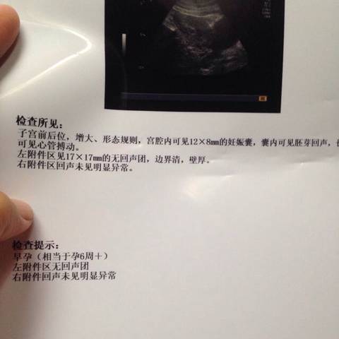 journal_insert_pic_701658425