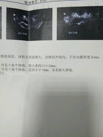 journal_insert_pic_703147045