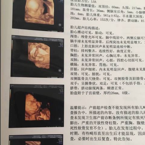 journal_insert_pic_703986374