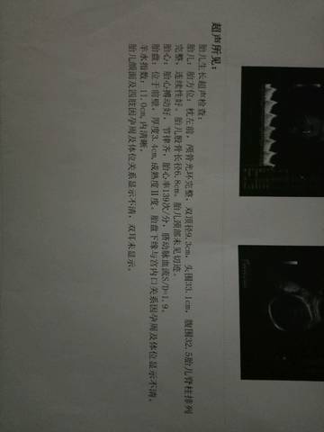 journal_insert_pic_704035359
