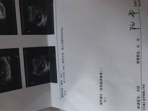 journal_insert_pic_704830047