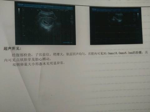 journal_insert_pic_705382667
