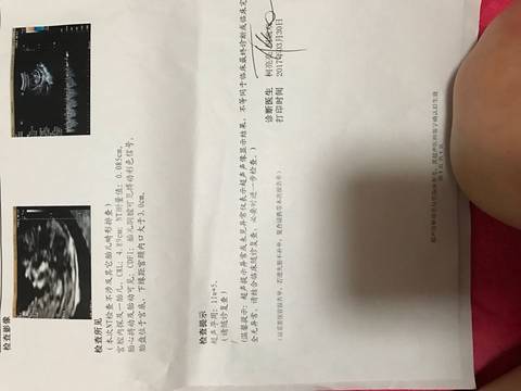 journal_insert_pic_705847988