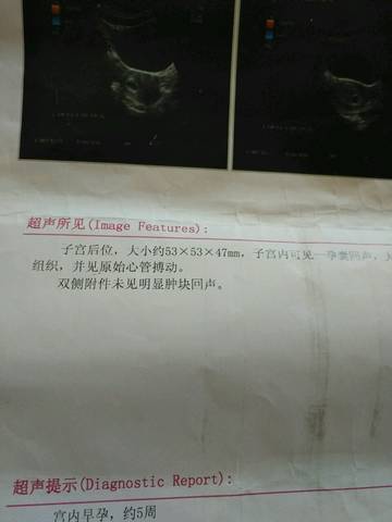 journal_insert_pic_706930333