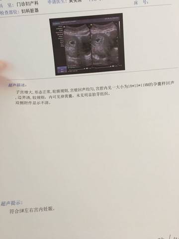 journal_insert_pic_707007919
