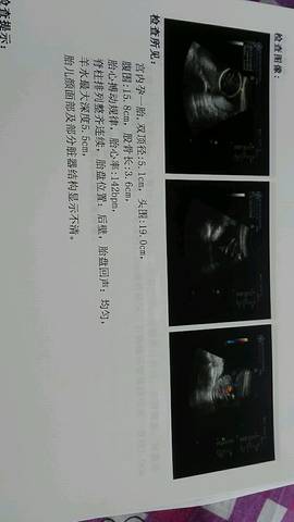 journal_insert_pic_706737412