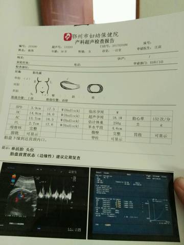 journal_insert_pic_707748215