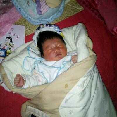 在宝宝出生时因为难产,生出头后就掐住了,导致脸上变黑紫,现在几天