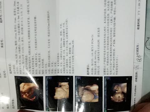 journal_insert_pic_710389075