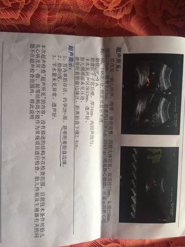 journal_insert_pic_710272748