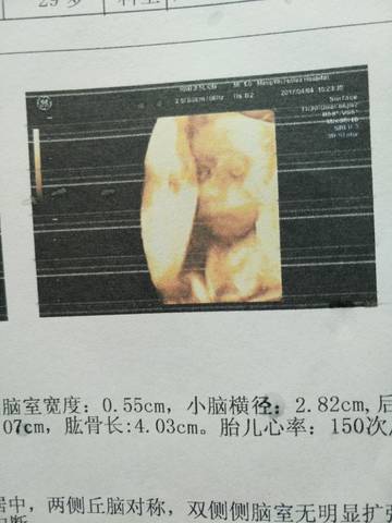 journal_insert_pic_709851359