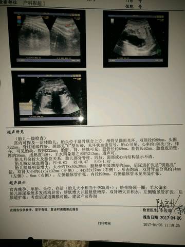 journal_insert_pic_711343545