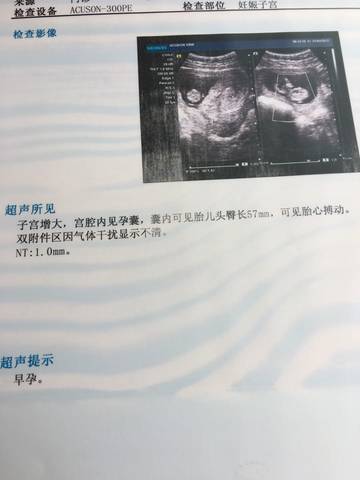 journal_insert_pic_711912793