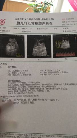 journal_insert_pic_712164614