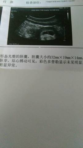 journal_insert_pic_711696218