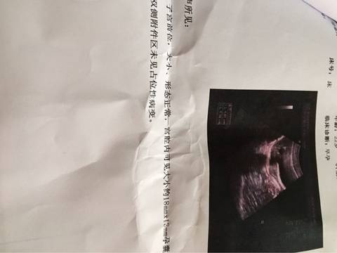 journal_insert_pic_713704203