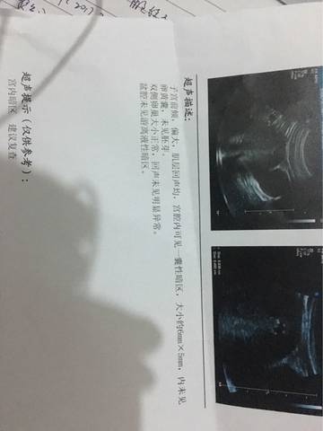 journal_insert_pic_715800275