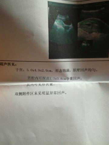 journal_insert_pic_718566558