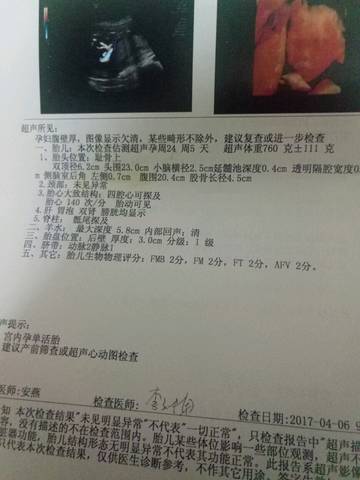 journal_insert_pic_721380290