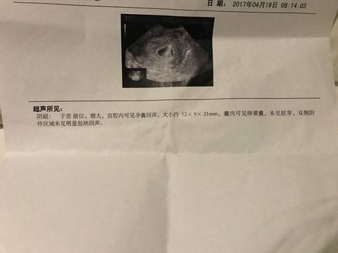 journal_insert_pic_721922131