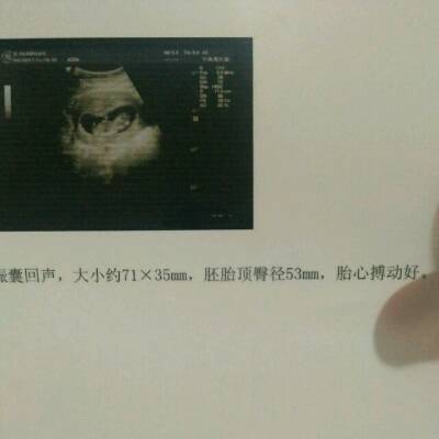 journal_insert_pic_723065465