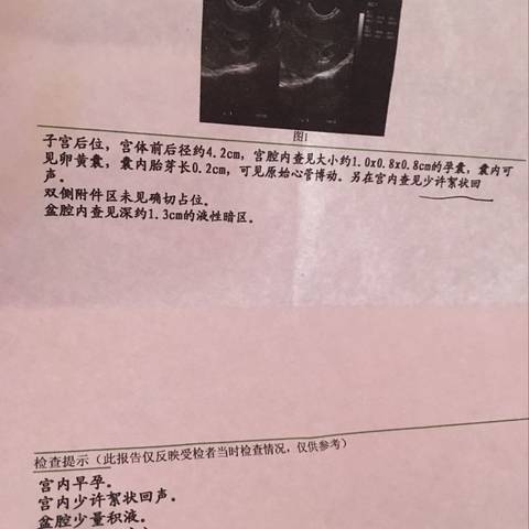 journal_insert_pic_722681290