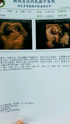 journal_insert_pic_723485327