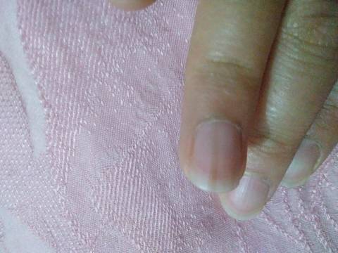我的手指甲一直有一道灰黑色的线