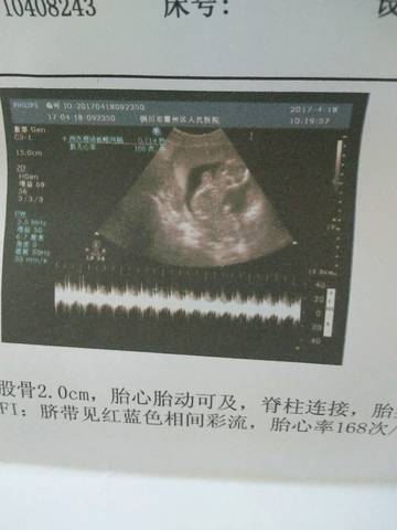 journal_insert_pic_725902001