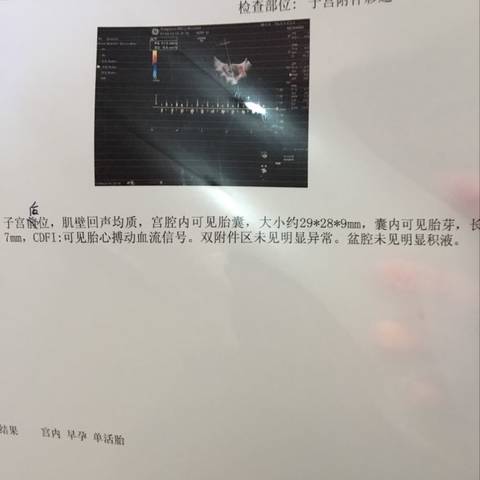 journal_insert_pic_725737089