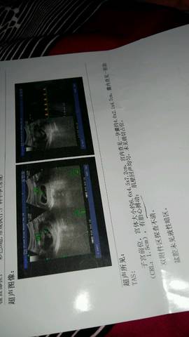 journal_insert_pic_727267447