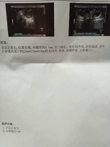 journal_insert_pic_727385695