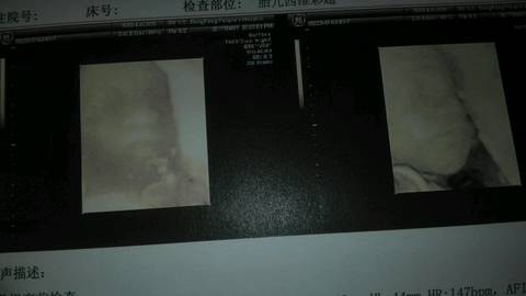 journal_insert_pic_727480480