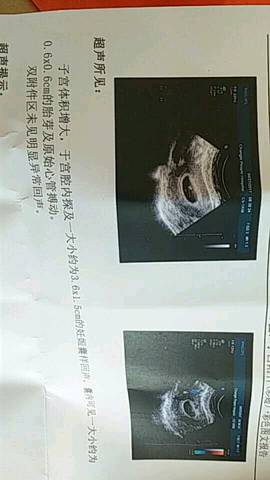 journal_insert_pic_728057319