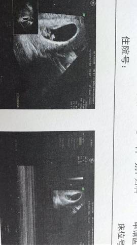 journal_insert_pic_728207758