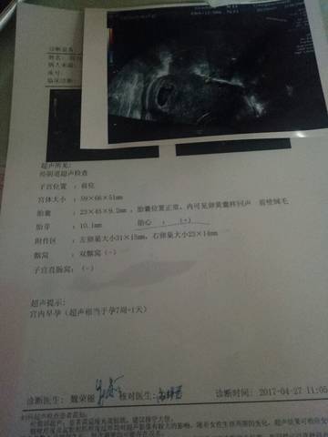 journal_insert_pic_729070415