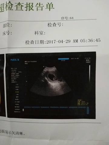 journal_insert_pic_729825116