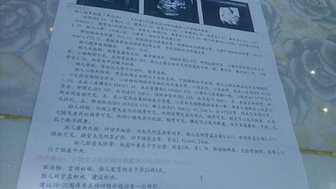 journal_insert_pic_731874440