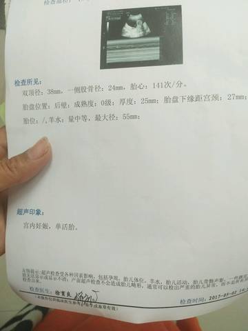 journal_insert_pic_732146594