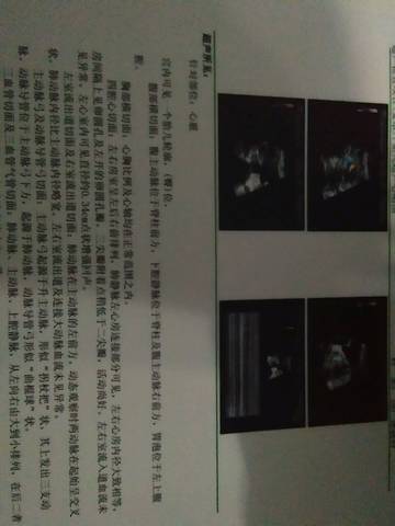 journal_insert_pic_732491881